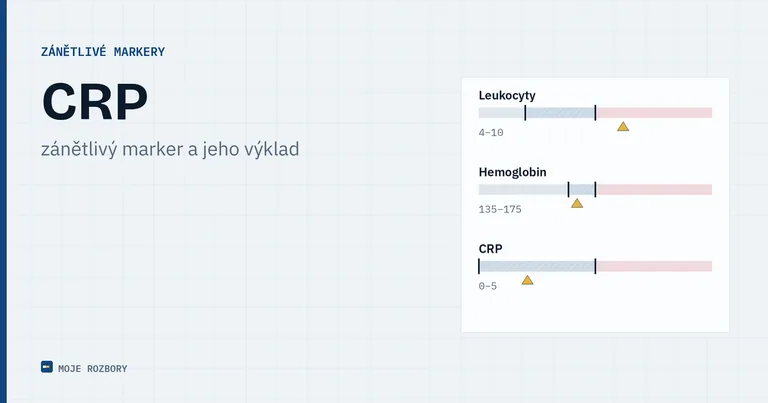 Titulní obrázek článku o hodnotách CRP s názvem parametru a podtitulem o zánětlivém markeru