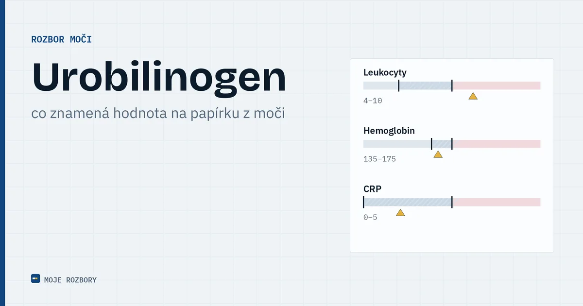 Titulní obrázek článku o urobilinogenu v moči s názvem parametru a podtitulem