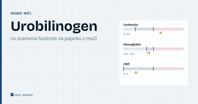 Titulní obrázek článku o urobilinogenu v moči s názvem parametru a podtitulem
